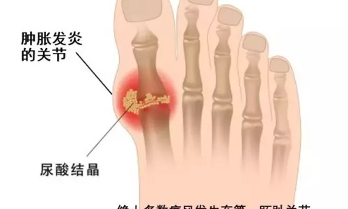 肝病会引起腰背部疼痛-肝炎引起腰痛专区_肝炎引起腰痛专区_肝病期间腰酸背痛是什么问题网